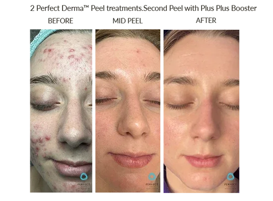 Before_After-Website-55_550x.webp