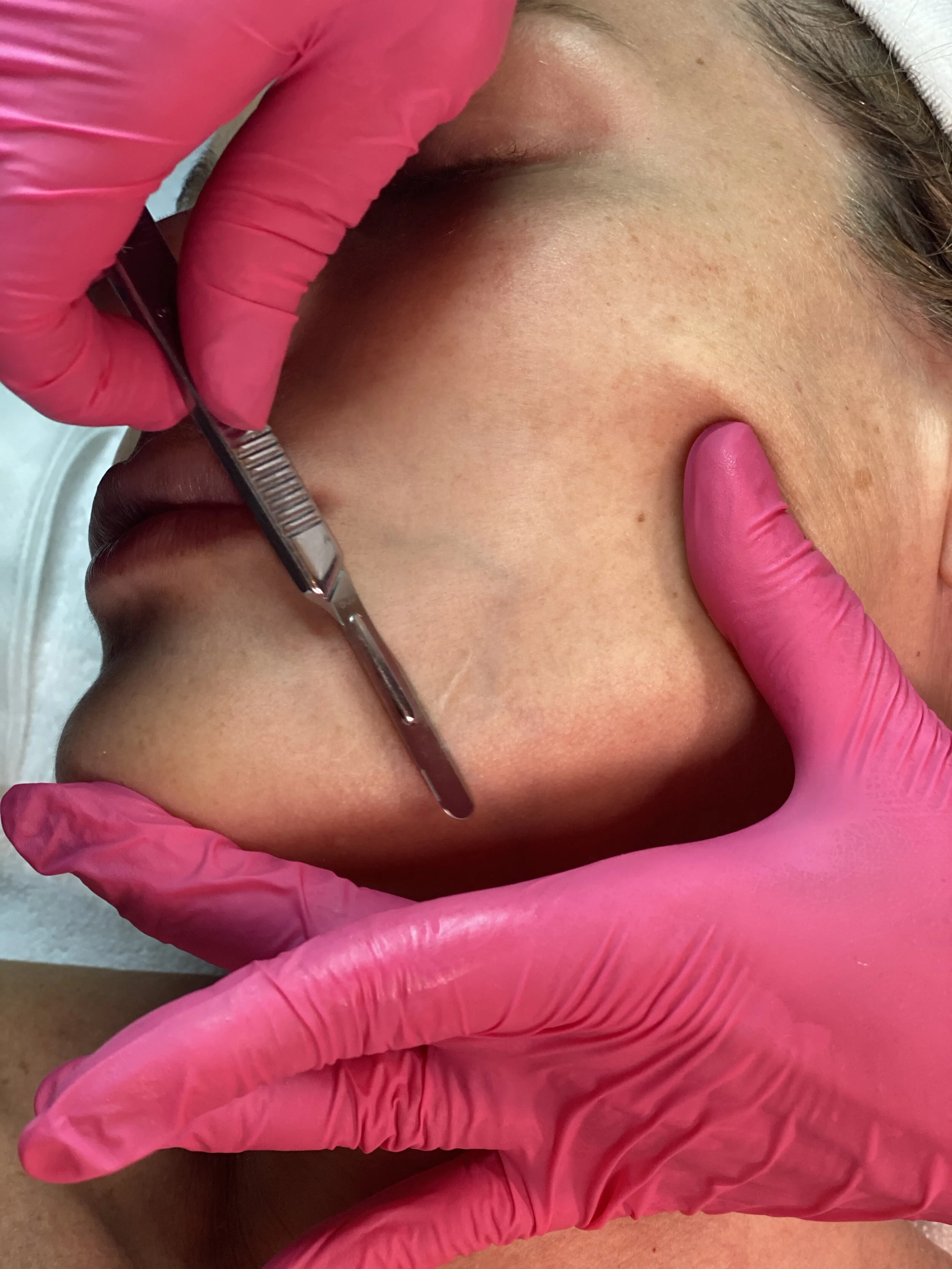 Client receiving dermaplaning service at Crystal Gayle Aesthetics