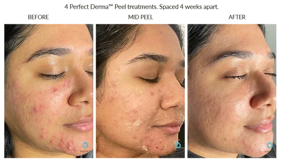 Before_After-Website-57_550x.webp