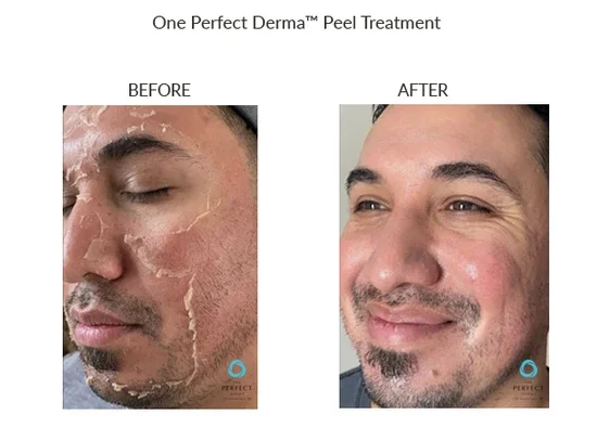 Before_After-Website-38_550x.webp