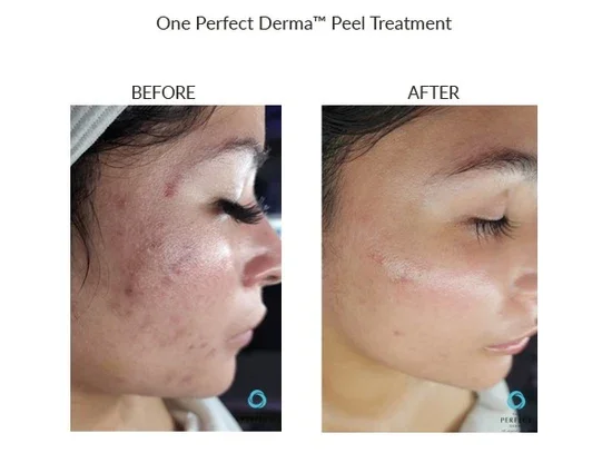 thumbnail_Before_After-38_550x.webp