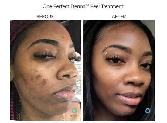 Before_After-Website-9_copy_8341bf9f-5330-4063-868e-d4f7b026502a_550x.webp