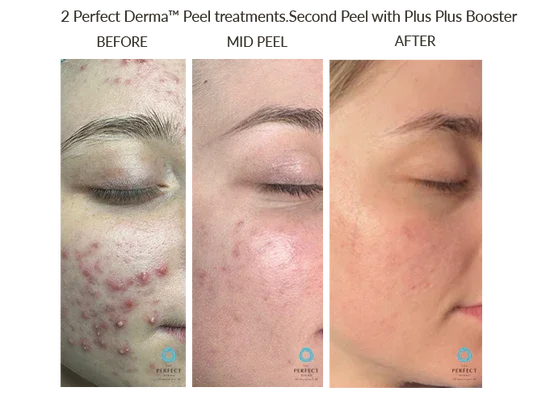 Before_After-Website-56_550x.webp