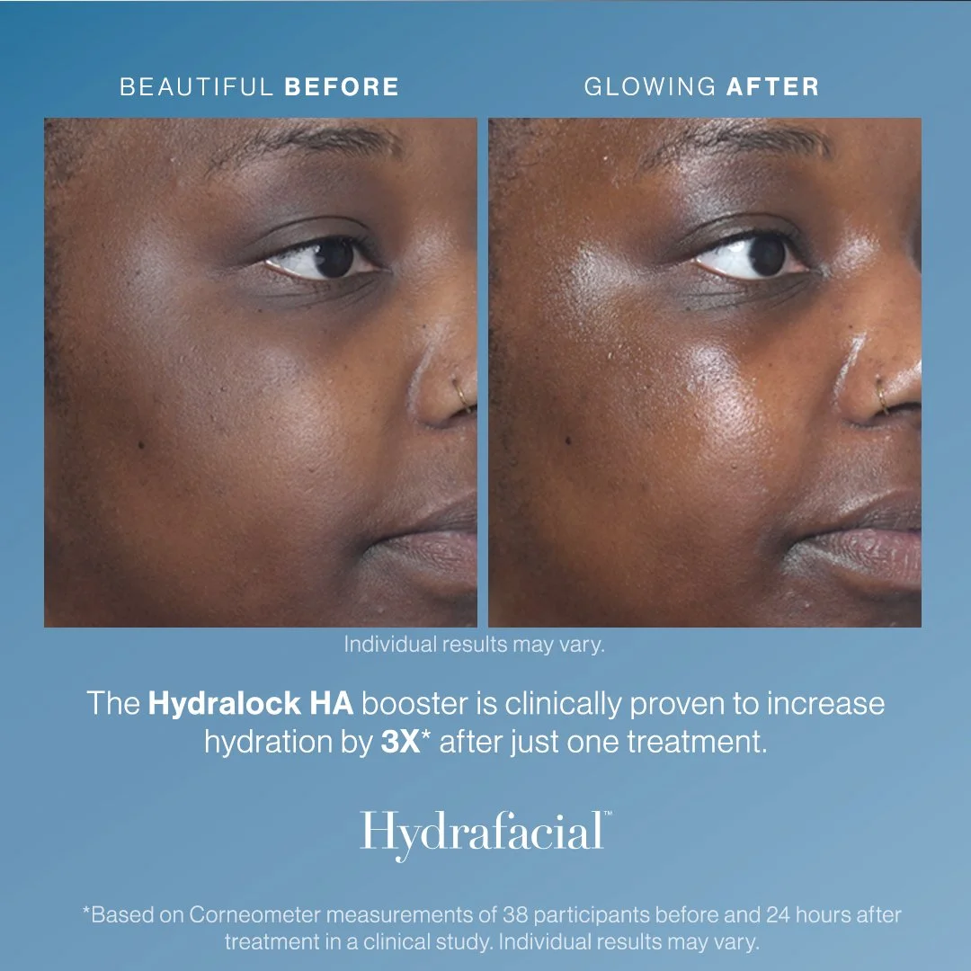 Side-by-side comparison of a woman's face before and after using Hydrolock HA booster, showing increased skin hydration and glow.
