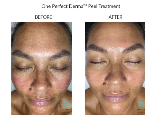 Before_After-2_550x.webp