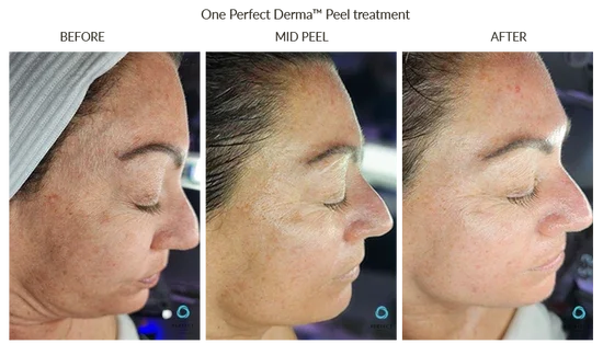 Before_After-Website-53_550x (1).webp