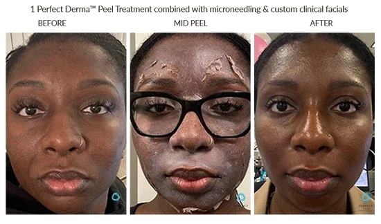Before_After-50_1_550x.webp