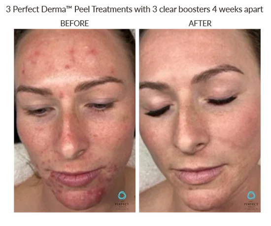 Before_After-Website-48_550x.webp