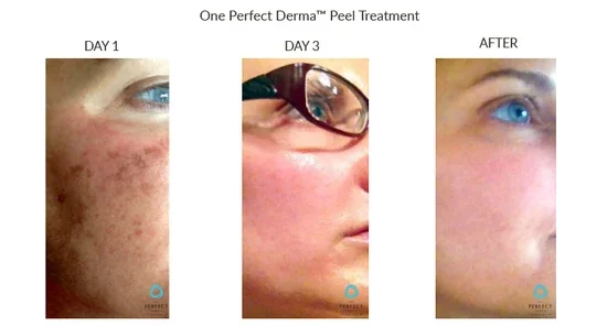 Before_After-Website-17_copy_550x.webp