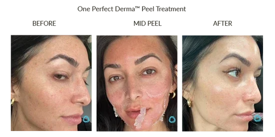Before_After-Website-42_550x (1).webp