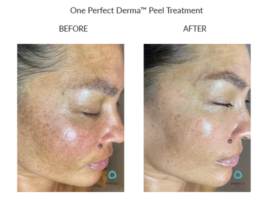 Before_After-3_7f602822-b34d-418f-aaf8-a6680a7ec950_550x.webp