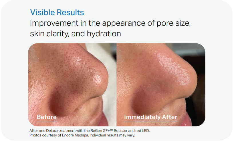 Visible Results Improvement in the appearance of pore size, skin clarity, and hydration