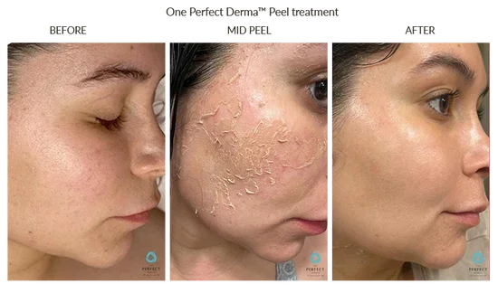 Before_After-52_550x.webp