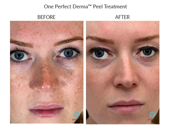 Before_After-Website-11_copy_550x.webp