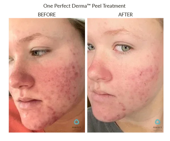 Before_After-Website-47_550x.webp