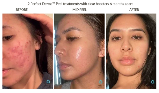 Before_After-51_550x.webp