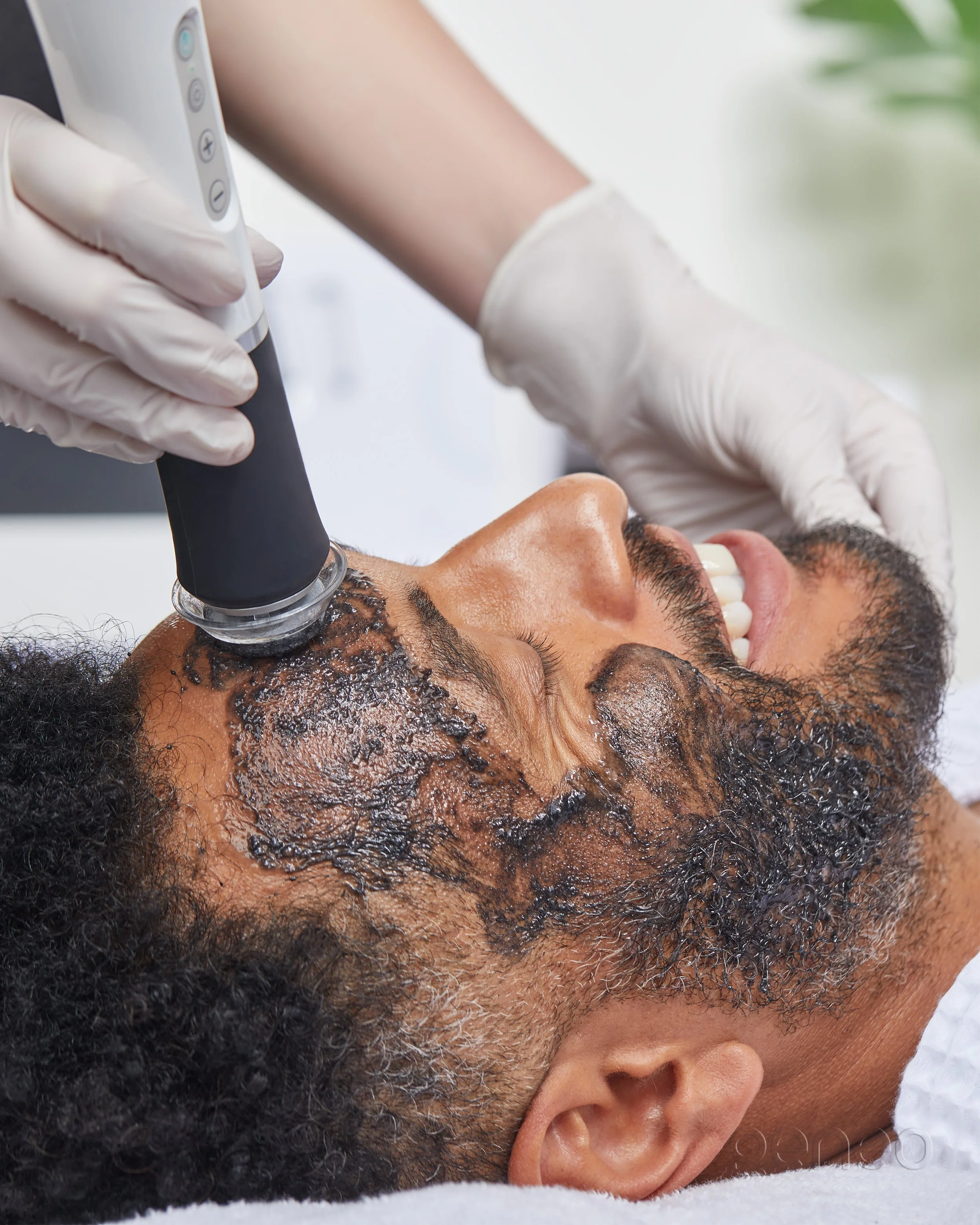 A person with curly hair receiving a Glo2Facial treatment with device applied to the forehead