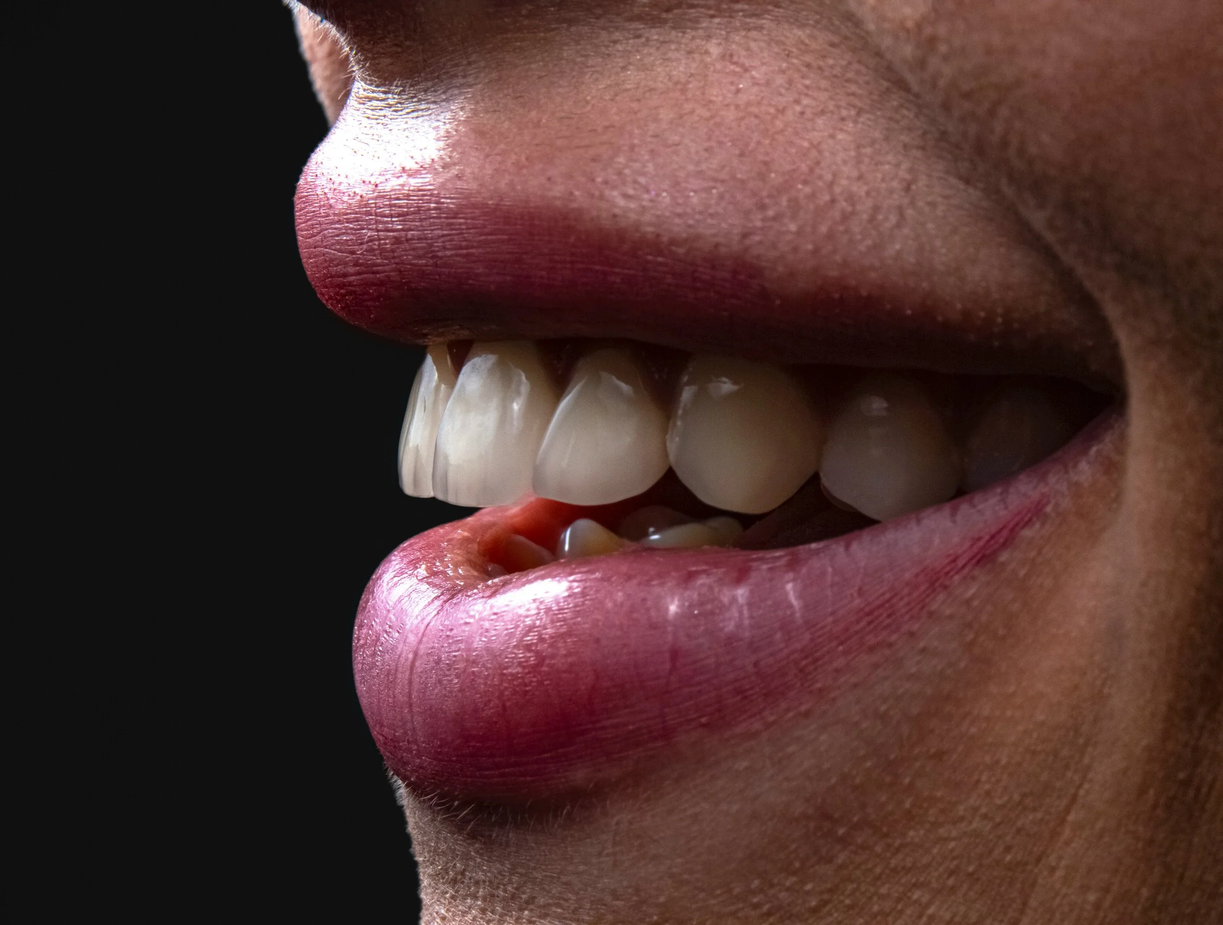 Porcelain vs. Zirconia Veneers: Which Option Is Right for Your Smile?