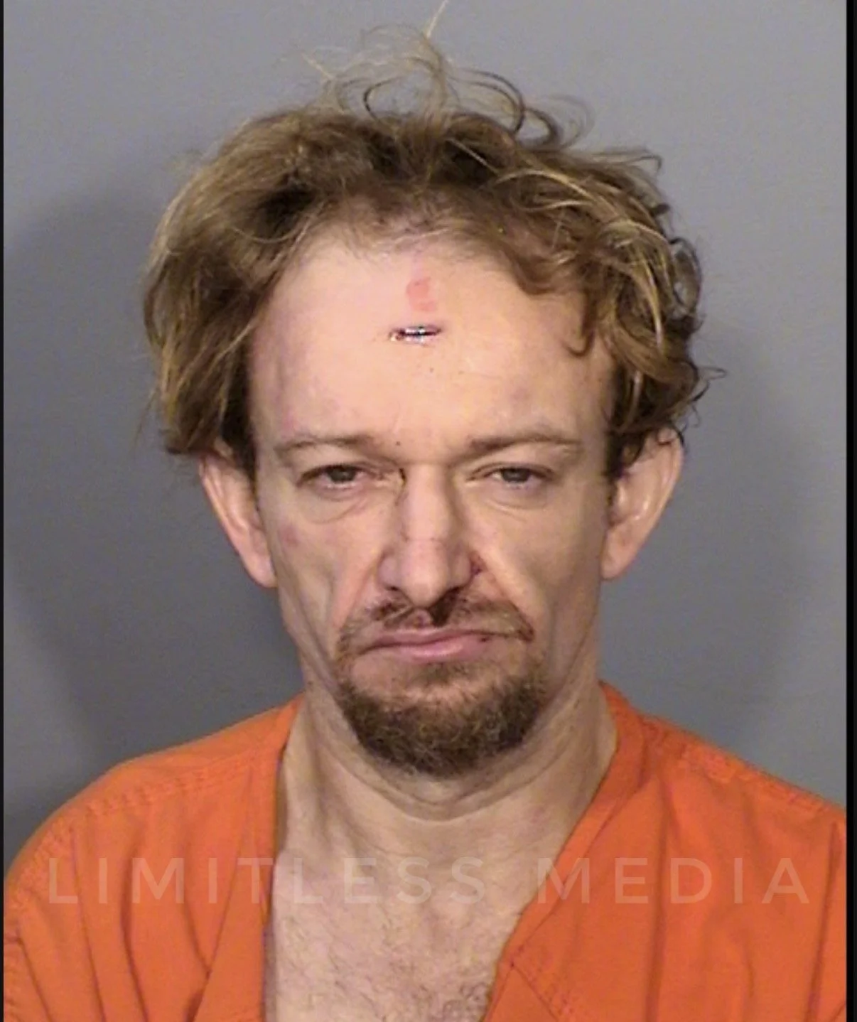 St. Paul Man Charged After Allegedly Slamming Head Against Squad Window, Spitting on Officer