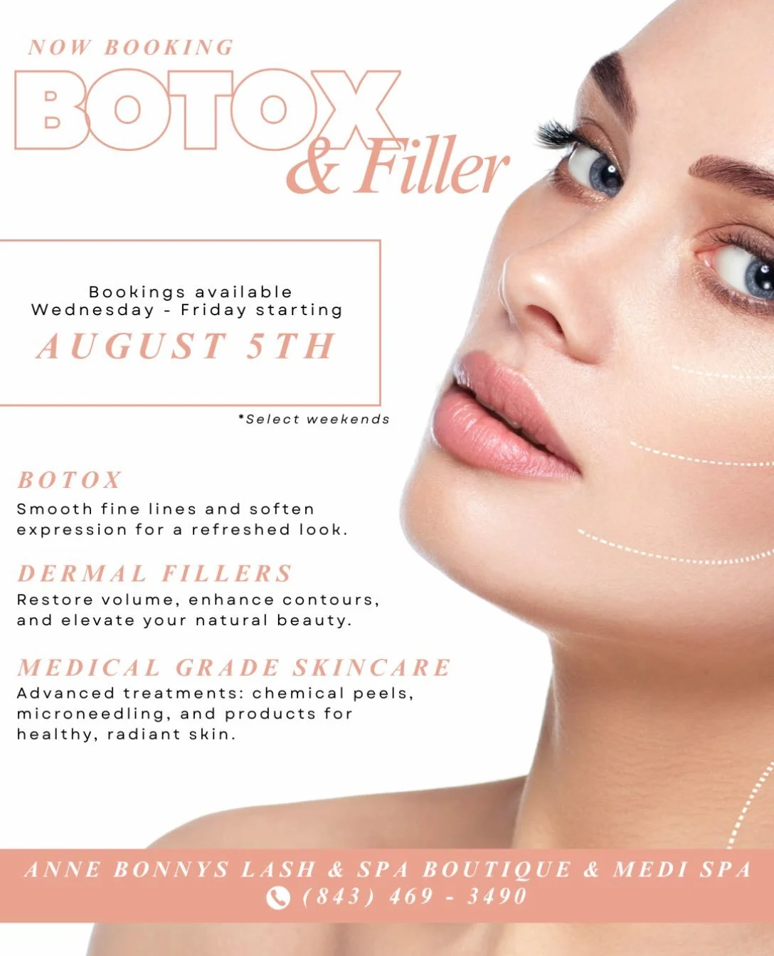 Botox, Dermal Fillers, and Medical-Grade Treatments and Skincare are officially coming to Anne Bonny&rsquo;s Lash &amp; Spa Boutique &amp; Medi Spa. 

Beginning August 5th, appointments will be available Wednesday&ndash;Friday, with select weekend ap