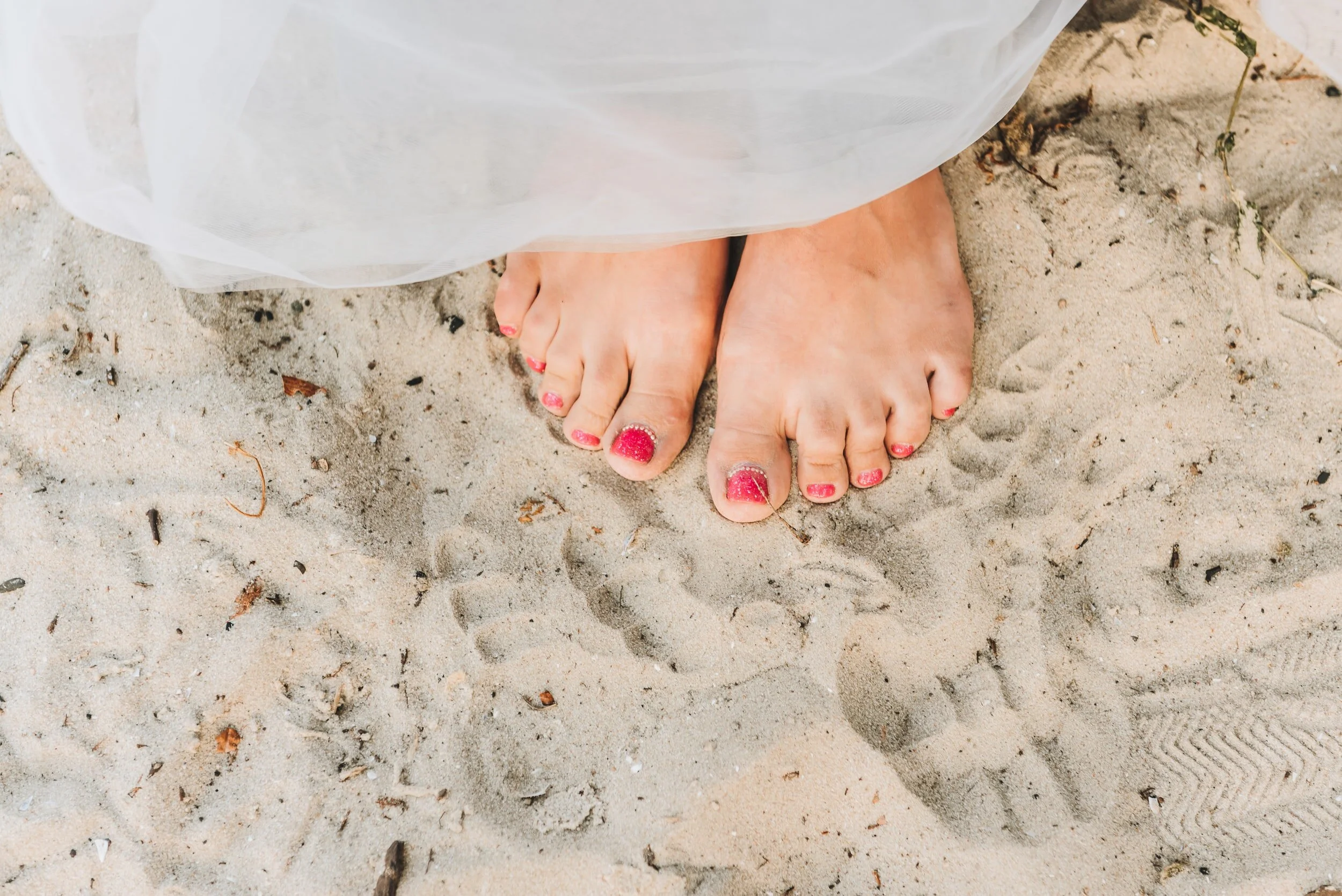 Everything You Need To Know About Fungal Nails