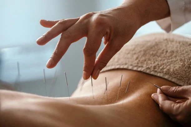 Acupuncture with Dr Eliza in Thornbury, Melbourne