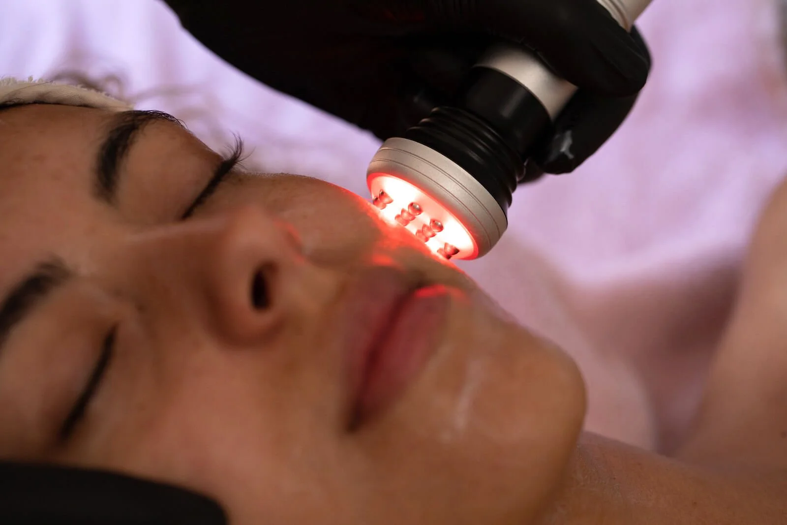 face and body by rachael harpenden hertfordshire facial skincare laser