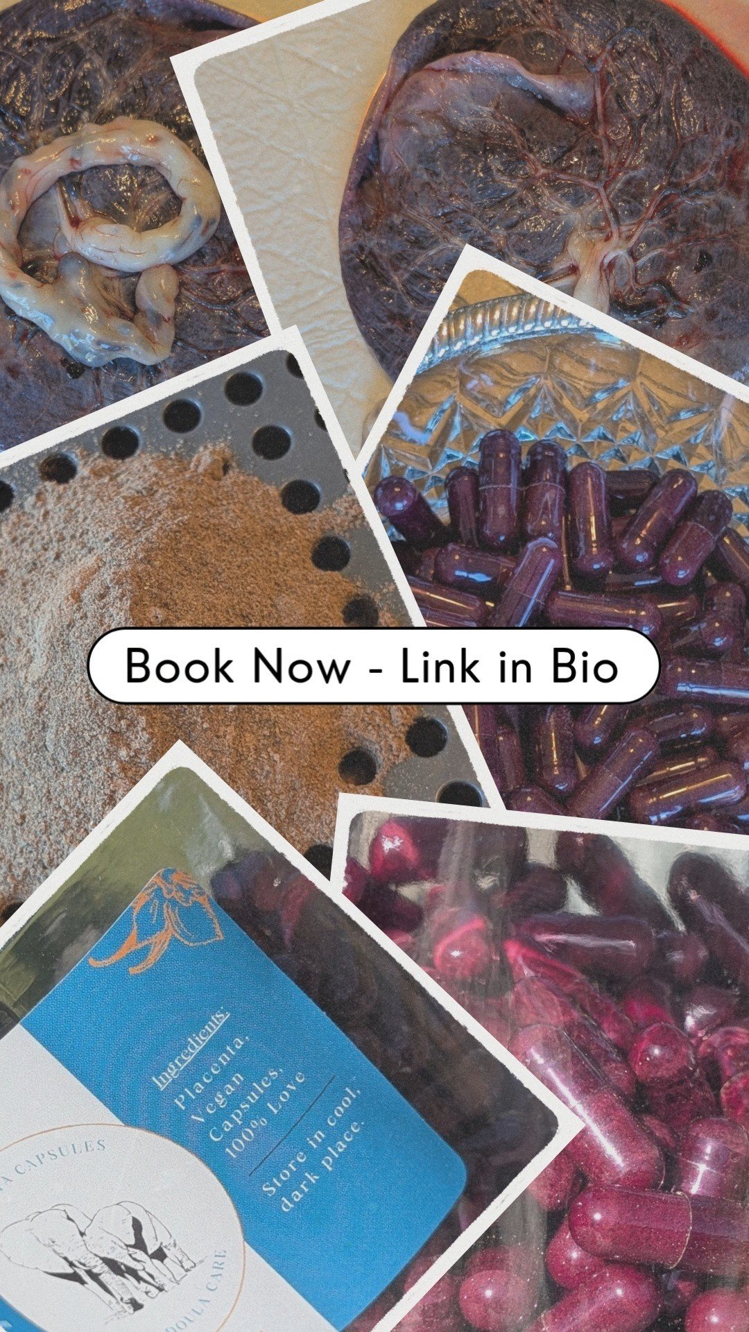 Placenta encapsulation is an incredible way to support postpartum recovery, providing essential nutrients and potentially enhancing mood and energy levels. Experience the benefits that many new parents rave about! If you're interested in learning mor
