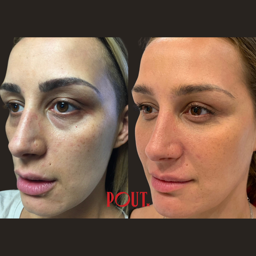 facial balancing
