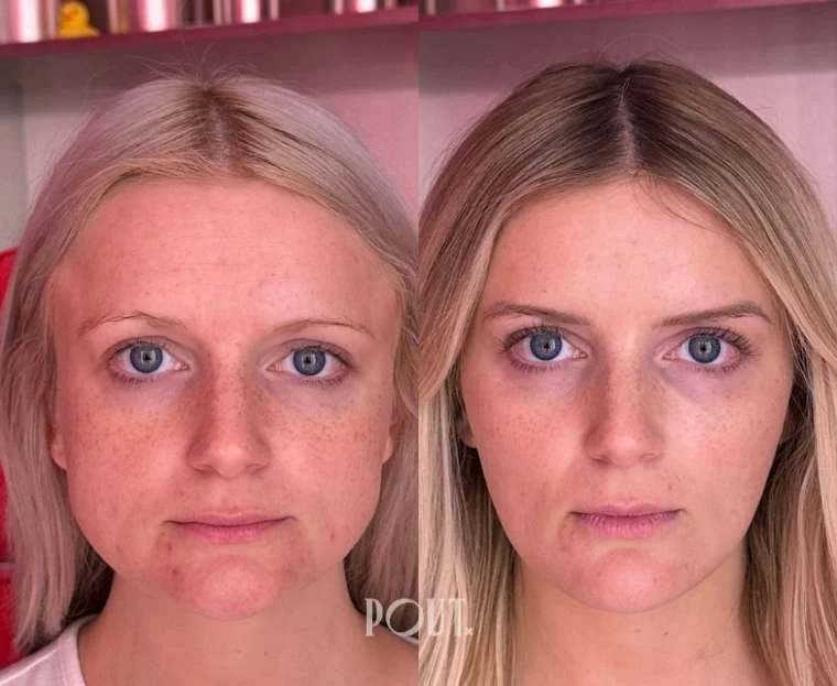 facial balancing