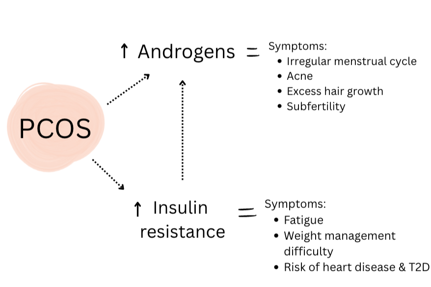 Hormonal imbalance of PCOS