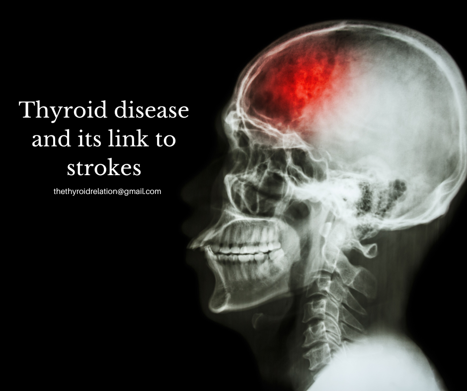 Hypothyroidism Blog The Thyroid Relation hypothyroidism-blog-the-thyroid-relation