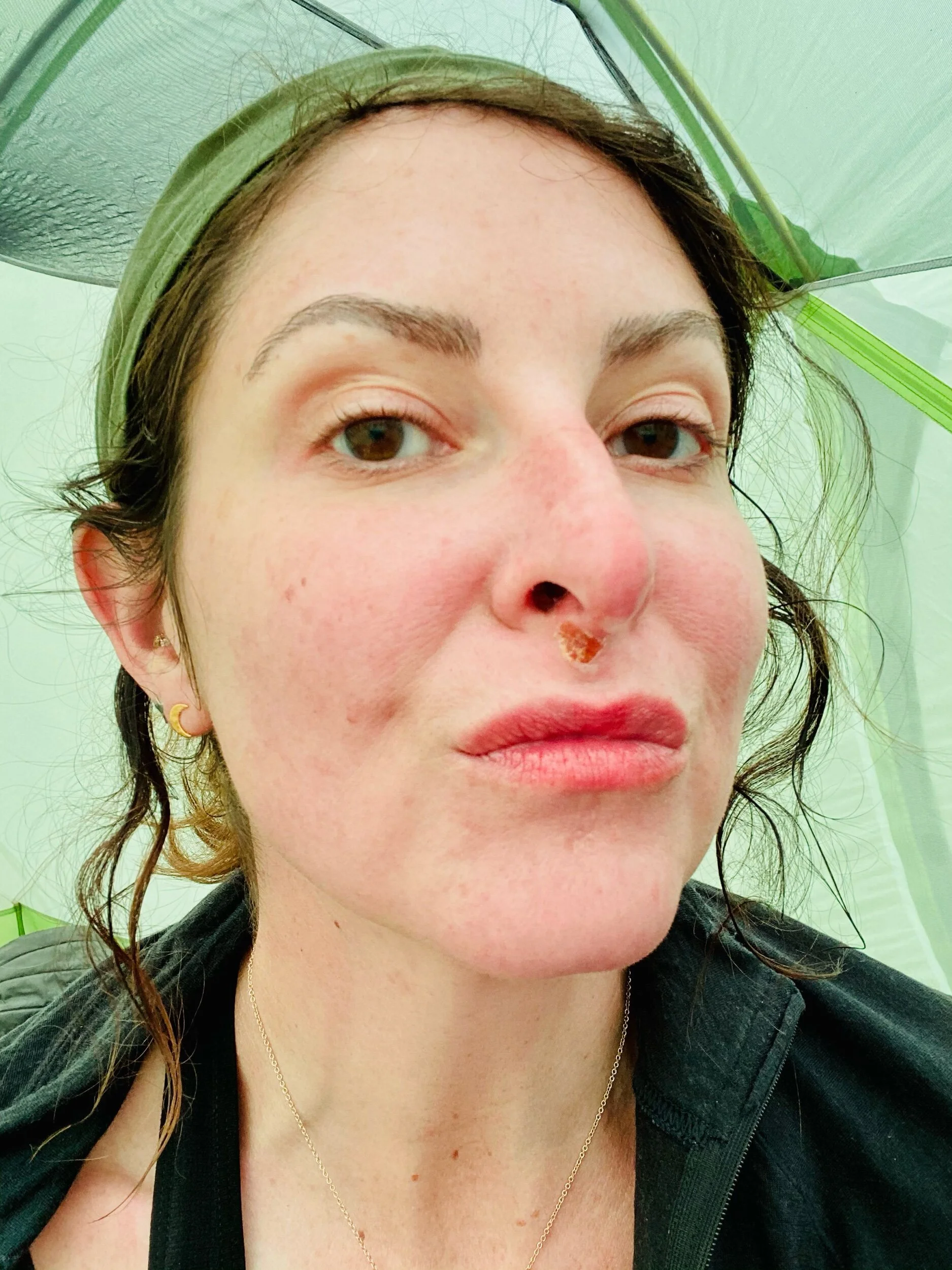 My newfound facial Ebola