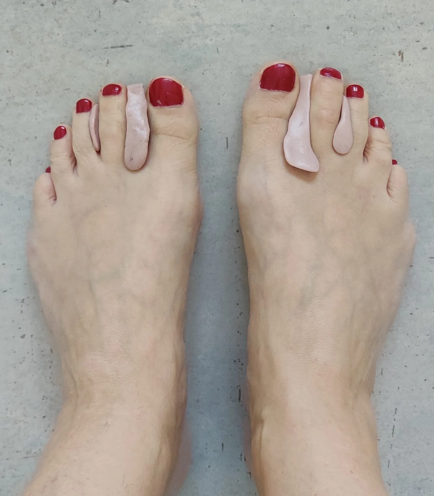 Ortoosit, apuvälineet