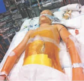 Medical team saves Jamie’s life