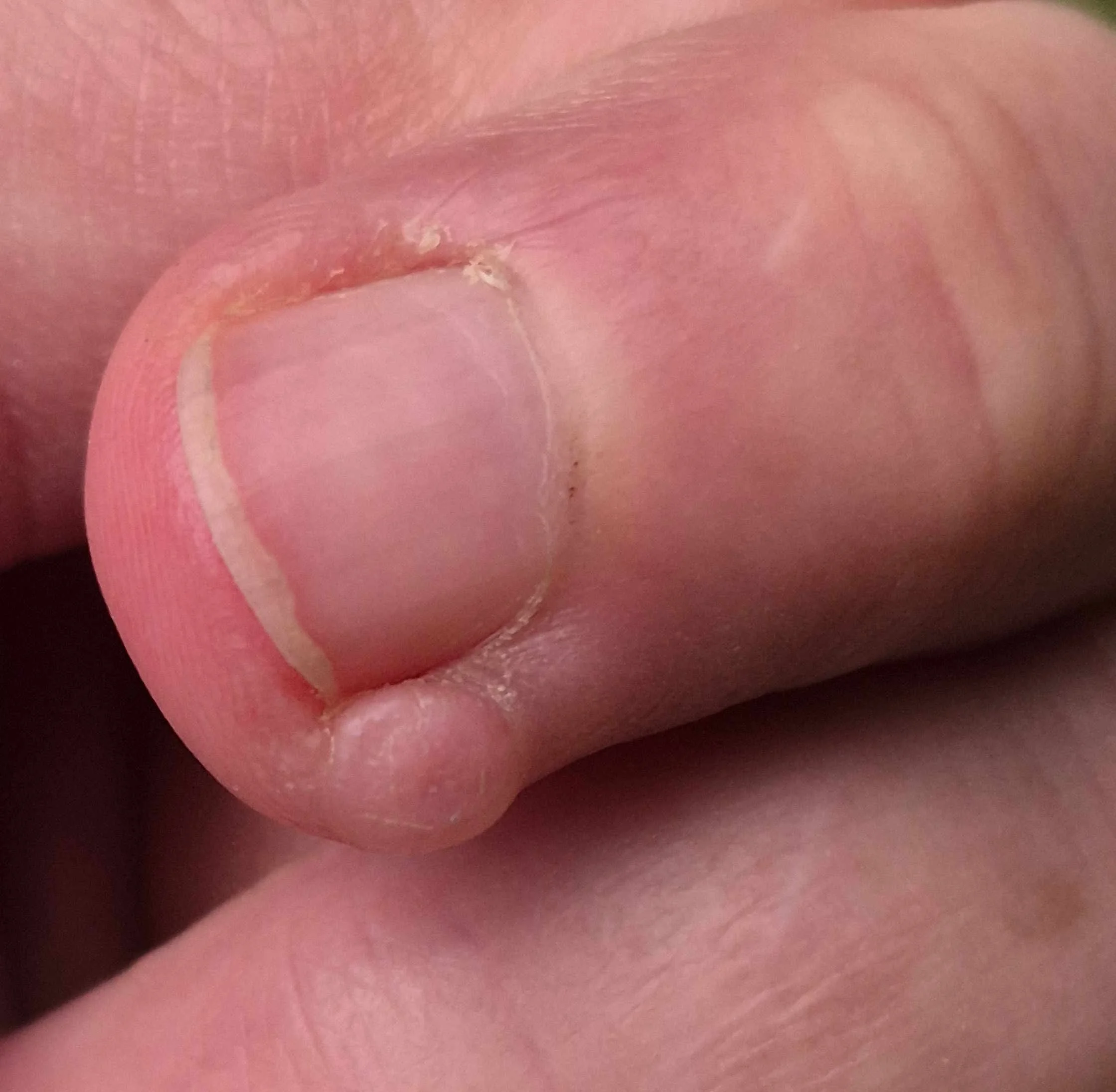 Skin picking to plastic surgery