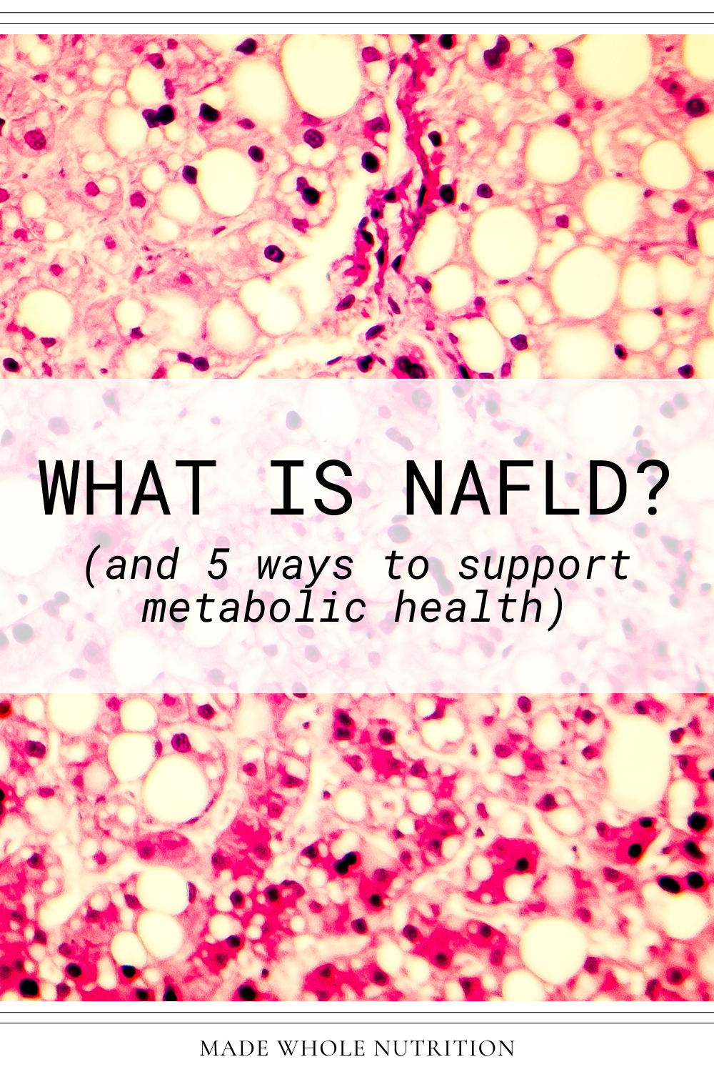 What is NAFLD? (and 5 ways to support metabolic health) — Functional ...