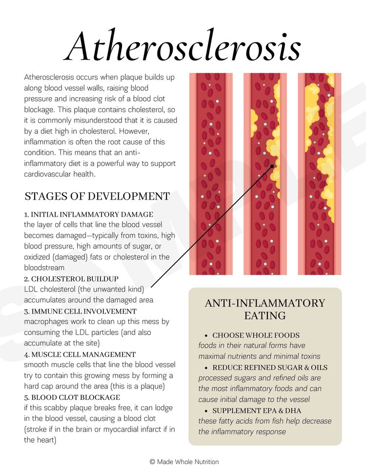 Atherosclerosis Handout — Functional Health Research + Resources — Made ...