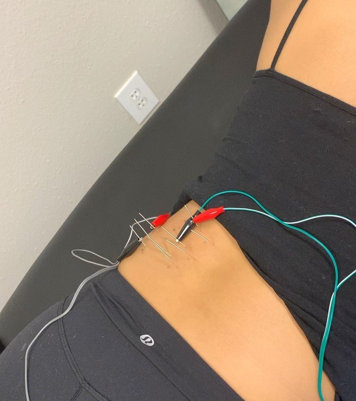 @shennaynayy came to see me for a low back strain. I used dry needling, intramuscular stimulation, and dynamic/PNF stretching to calm and speed up the healing process for her left QL and lumbar extensors. Swipe to hear her share her experience! ✨ 
&b