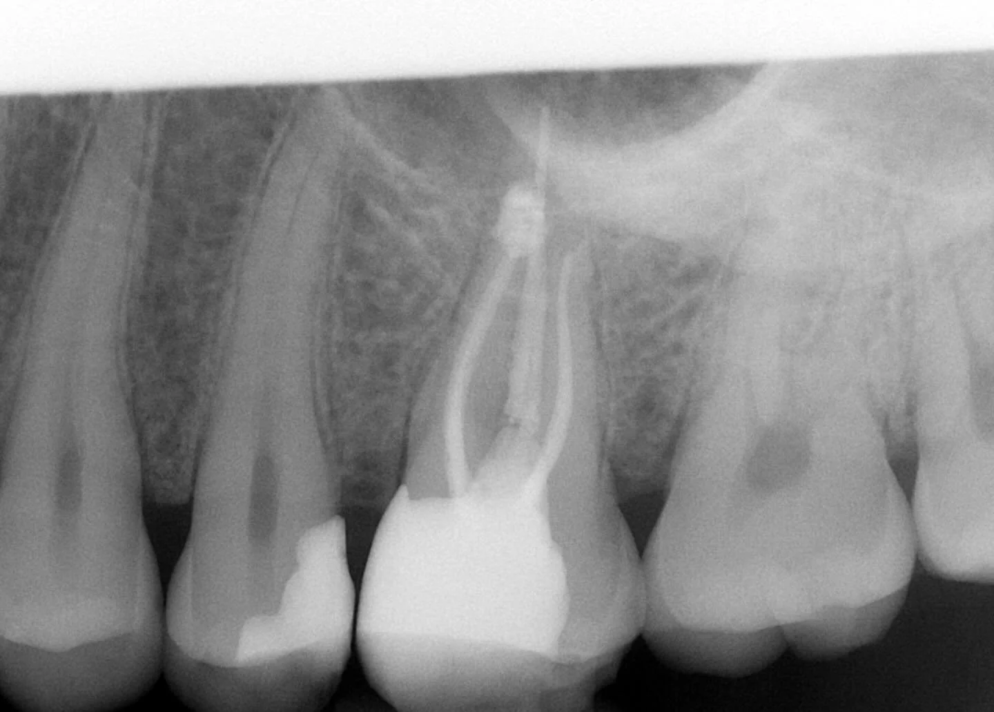 Still nice to get the correct emergence for a core