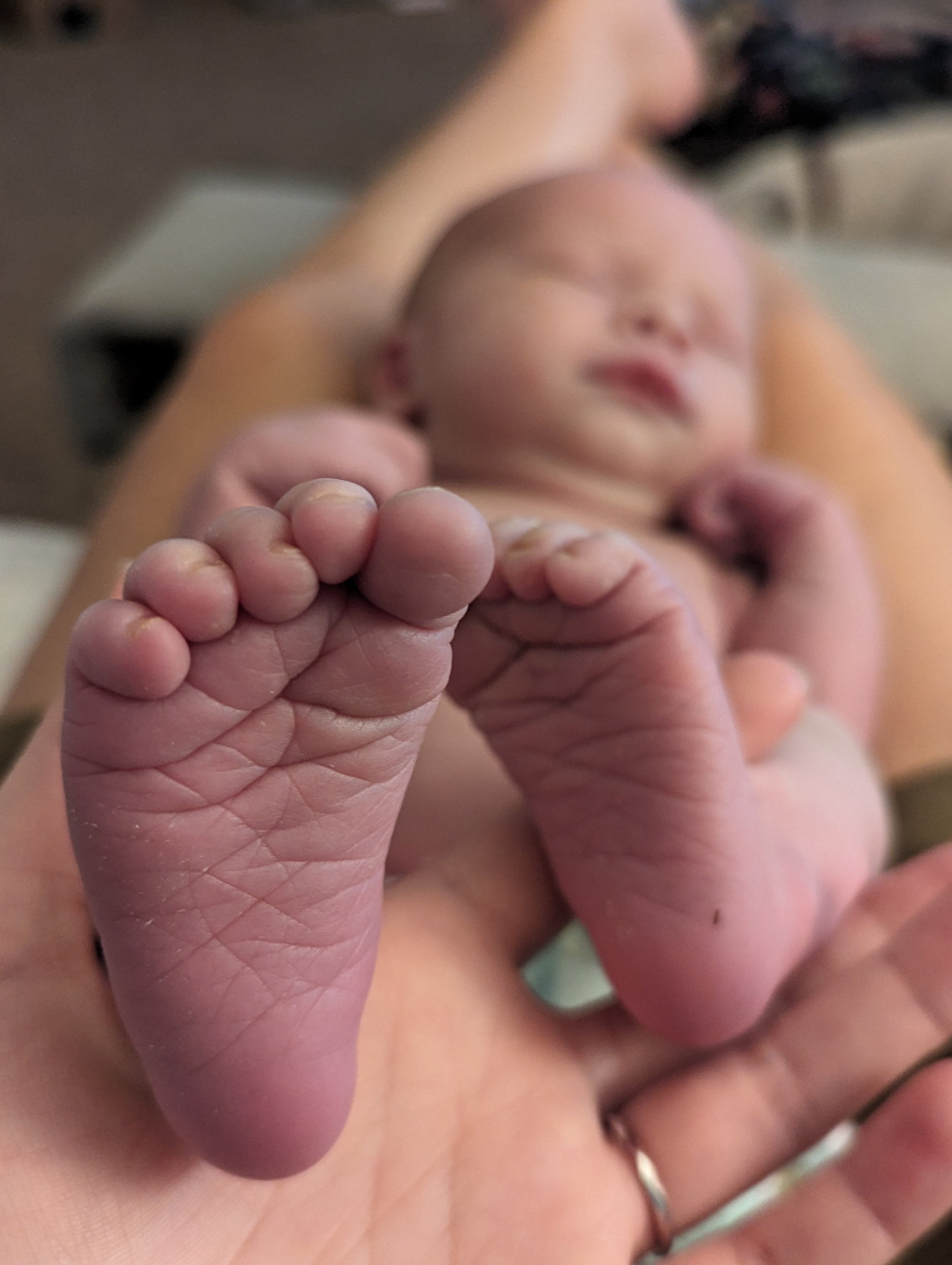 Newborn feet after metabolic newborn screen