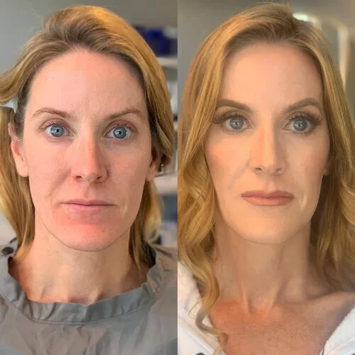 HausofBeautyNH-HeatherHylton-BeforeandAfter4.jpg