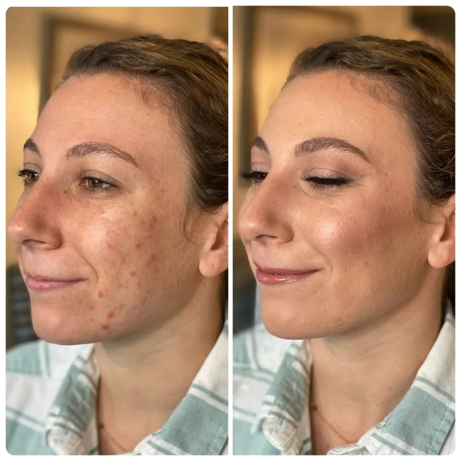 HausofBeautyNH-KellyFord-BeforeandAfter73-v2.jpg