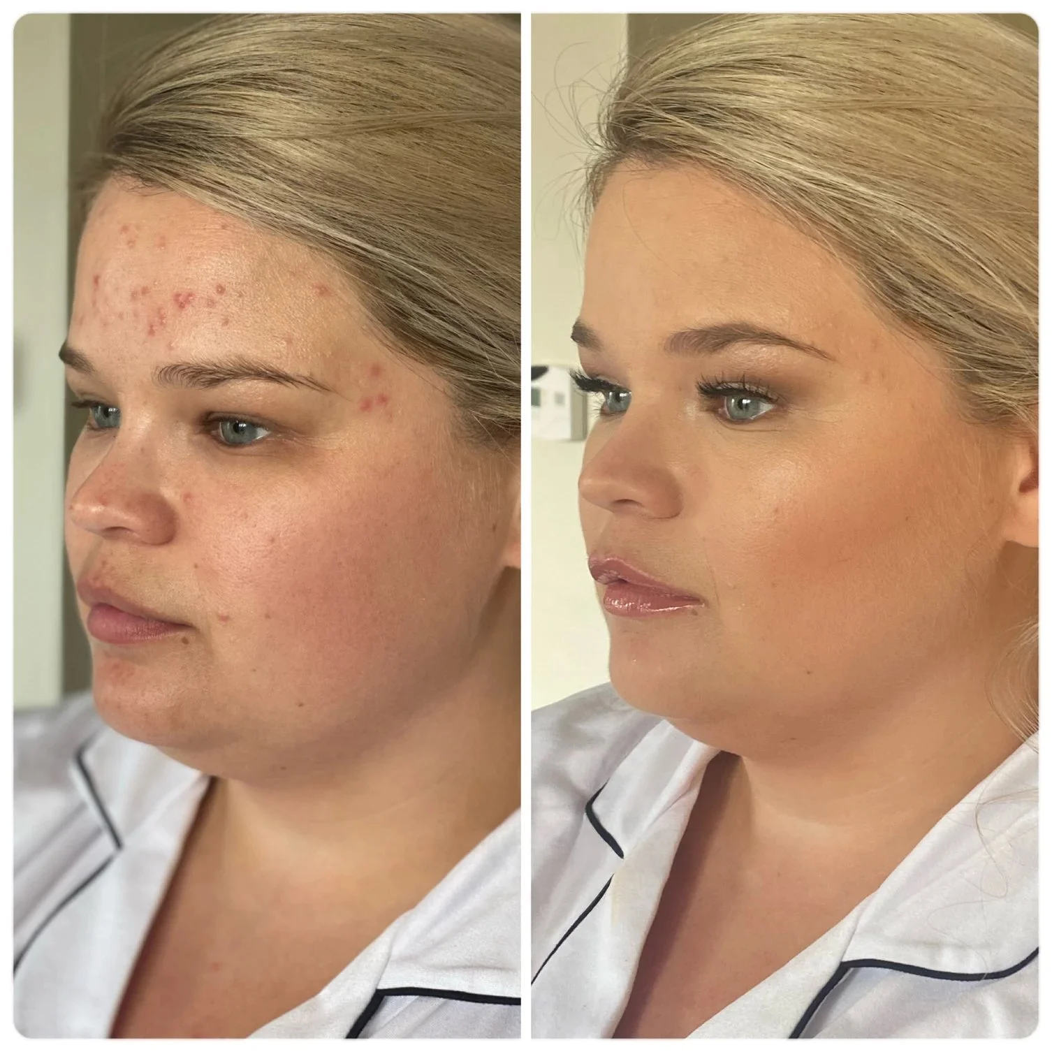 HausofBeautyNH-KellyFord-BeforeandAfter82-v2.jpg