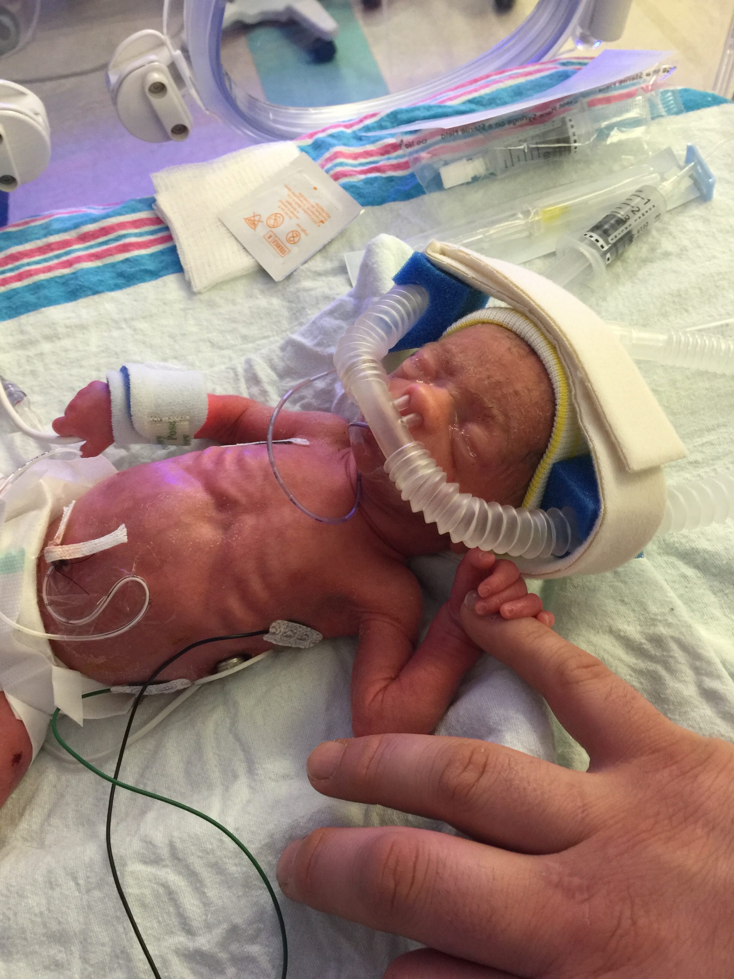 Right after she was born, holding her daddy’s finger.