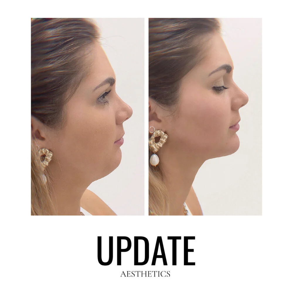 Nina Prisk Update Aesthetic