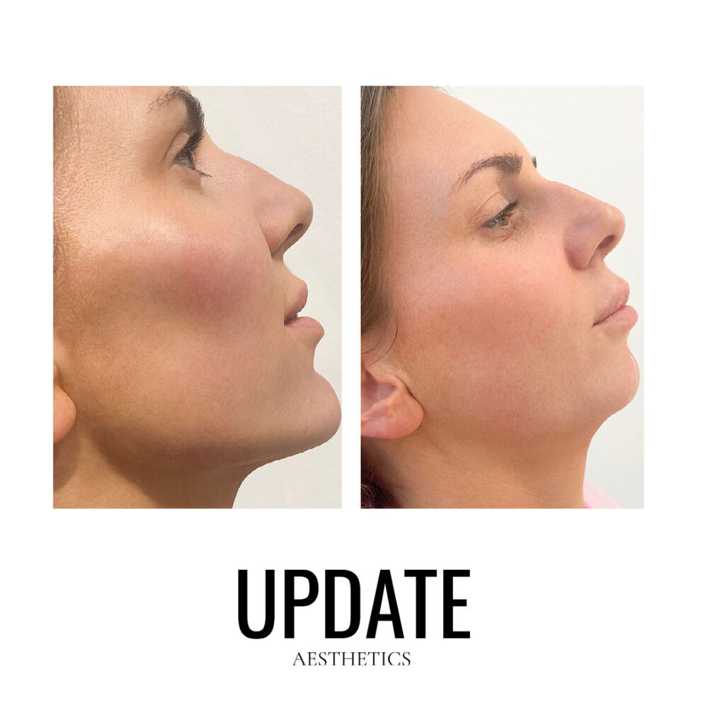 Nina Prisk Update Aesthetic