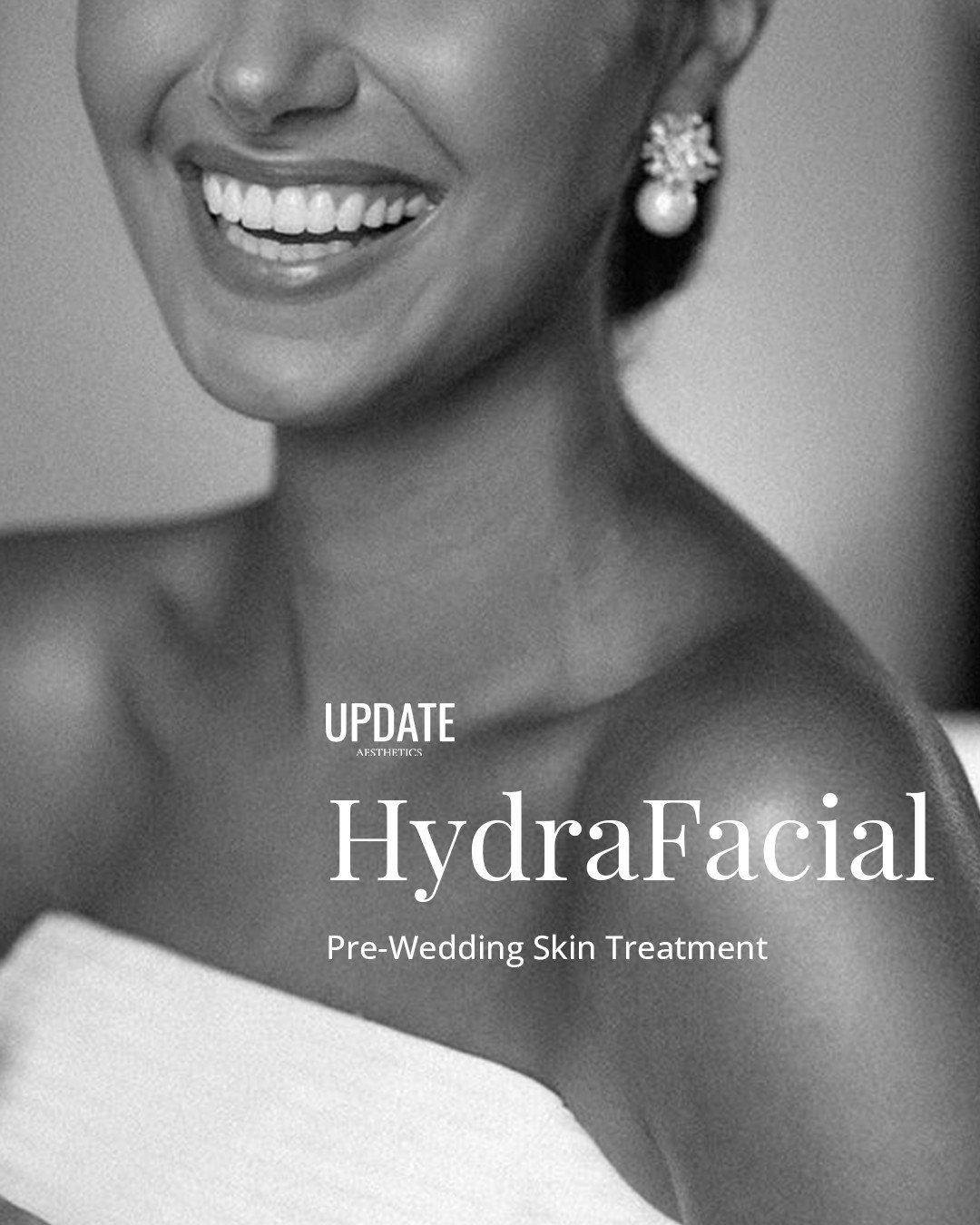 Prepping for your big day? ✨ ⁠
⁠
Get wedding-ready with Hydrafacial at Update Aesthetics! ⁠
⁠
Deep clean, hydrate, and glow in just one session. ⁠
⁠
#WeddingSkincare #HydrafacialGlow #London #HarleyStreet #Truro #Cornwall #NaturalAesthetics #NursePra