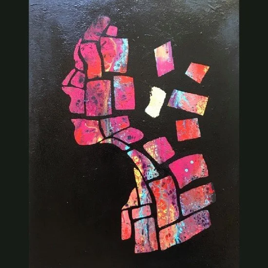 fracture
