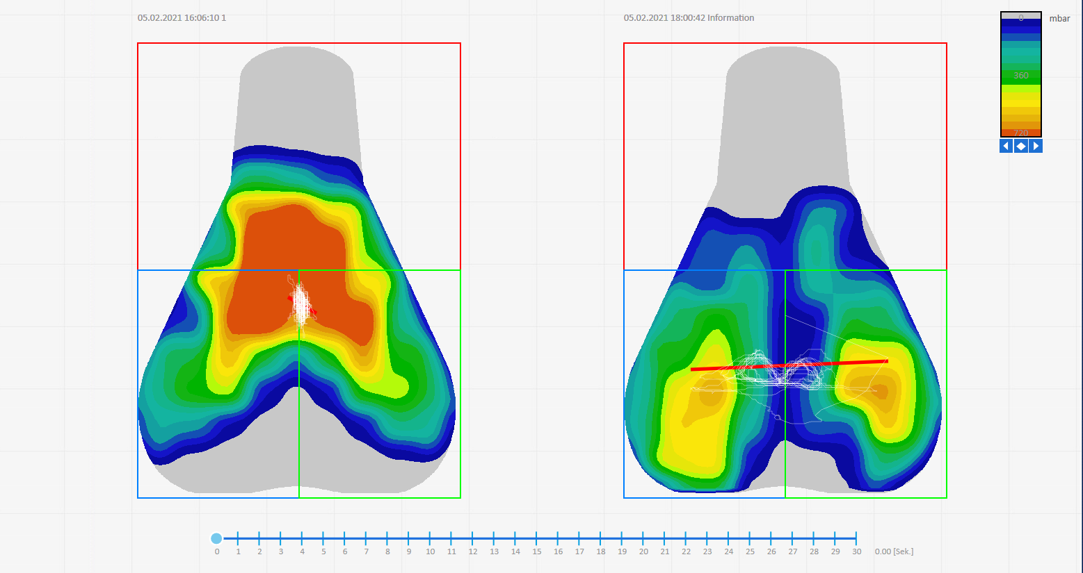 Spaudimo koncentracijos